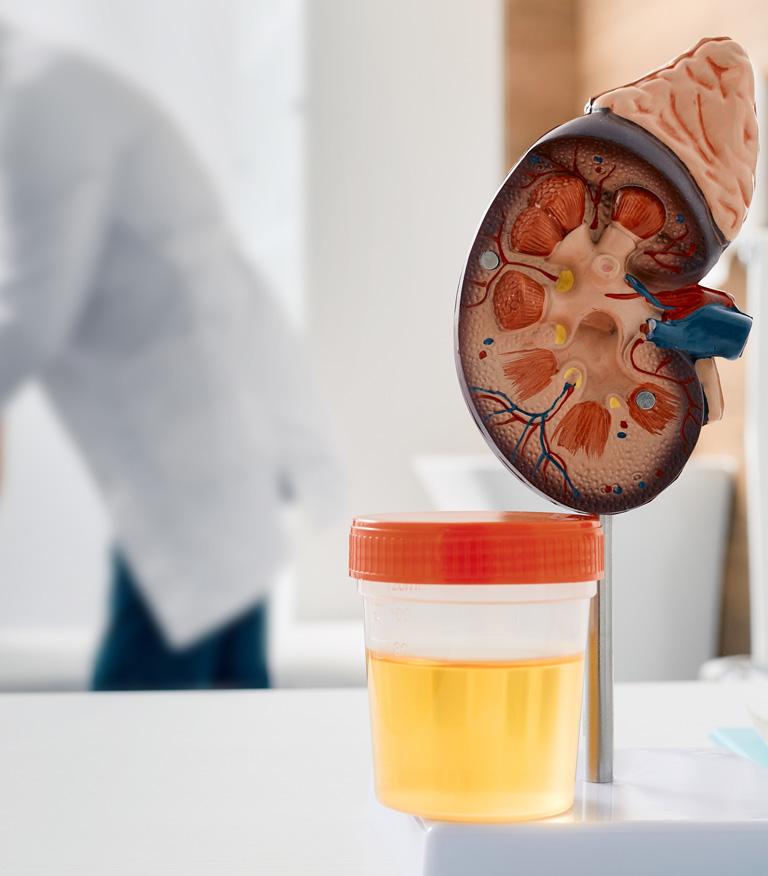 Chequeo de urología